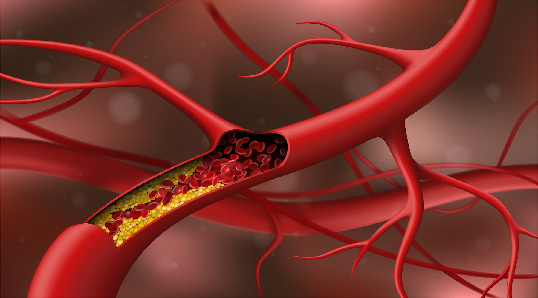 Blood Lipid Levels: What They Are and Why They Matter