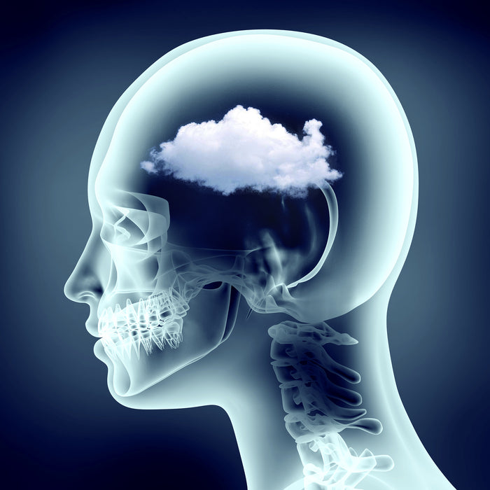 Brain Fog: How to Fix It & What Lifestyle Choices Lead to It