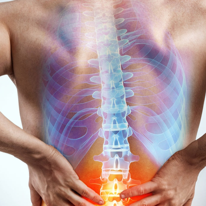 Functional Scoliosis, How You Sleep, and Why You're Hurting