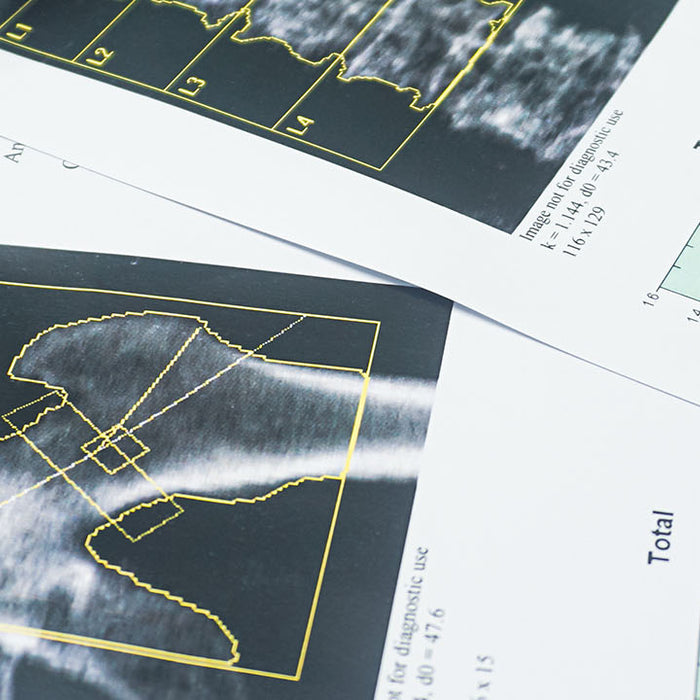 The Link Between Strength Training and Bone Health